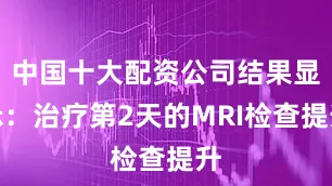 中国十大配资公司结果显示：治疗第2天的MRI检查提升