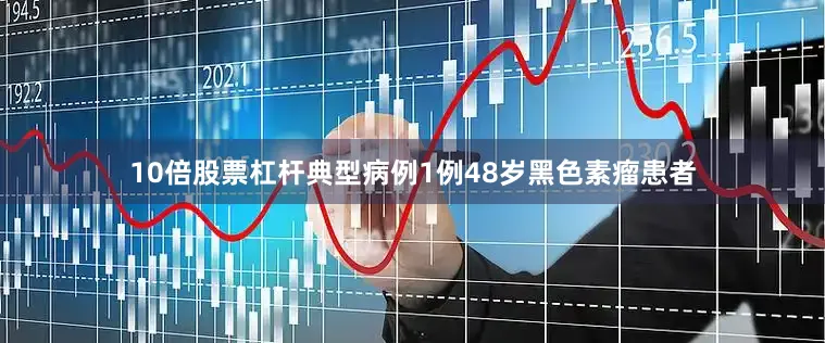 10倍股票杠杆典型病例1例48岁黑色素瘤患者